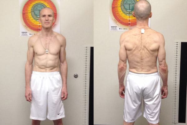 Client Transformation Stephen — Before and After